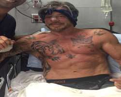 He suffered several injuries while working as a boxer like a split tongue and a compressed cheekbone.